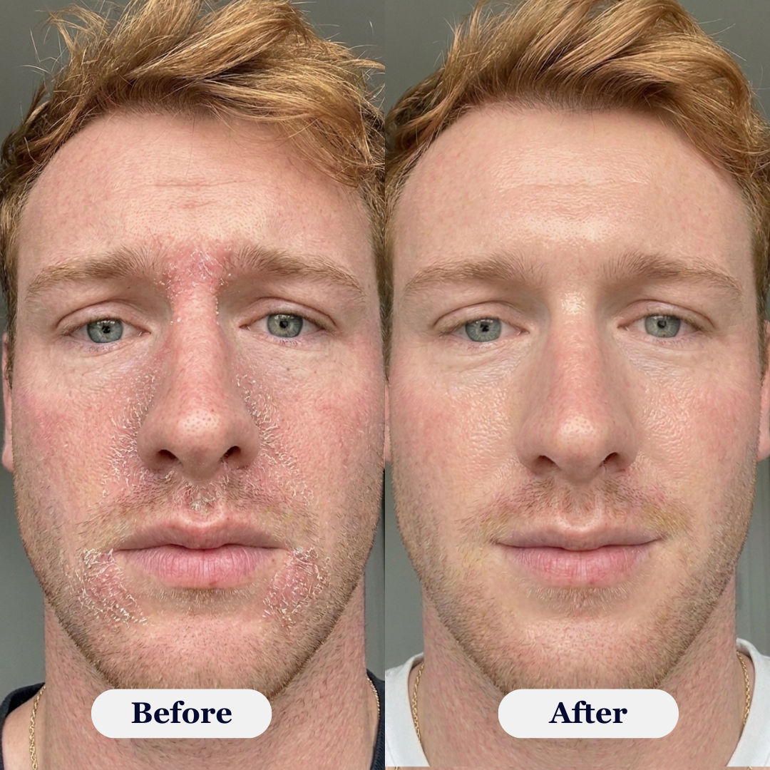 Rova Rejuvenating PDRN Cream