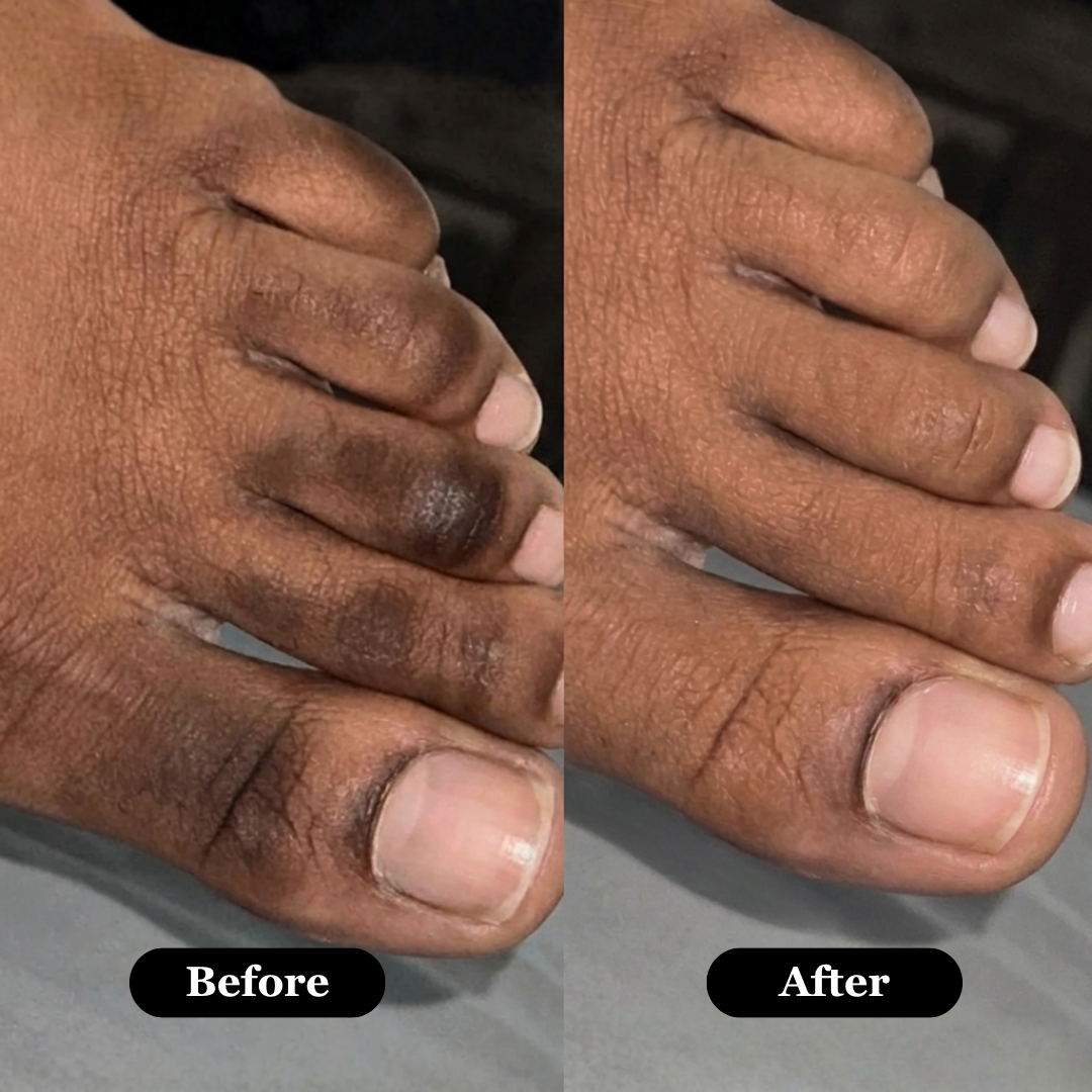 Rova Retinal Skin Booster