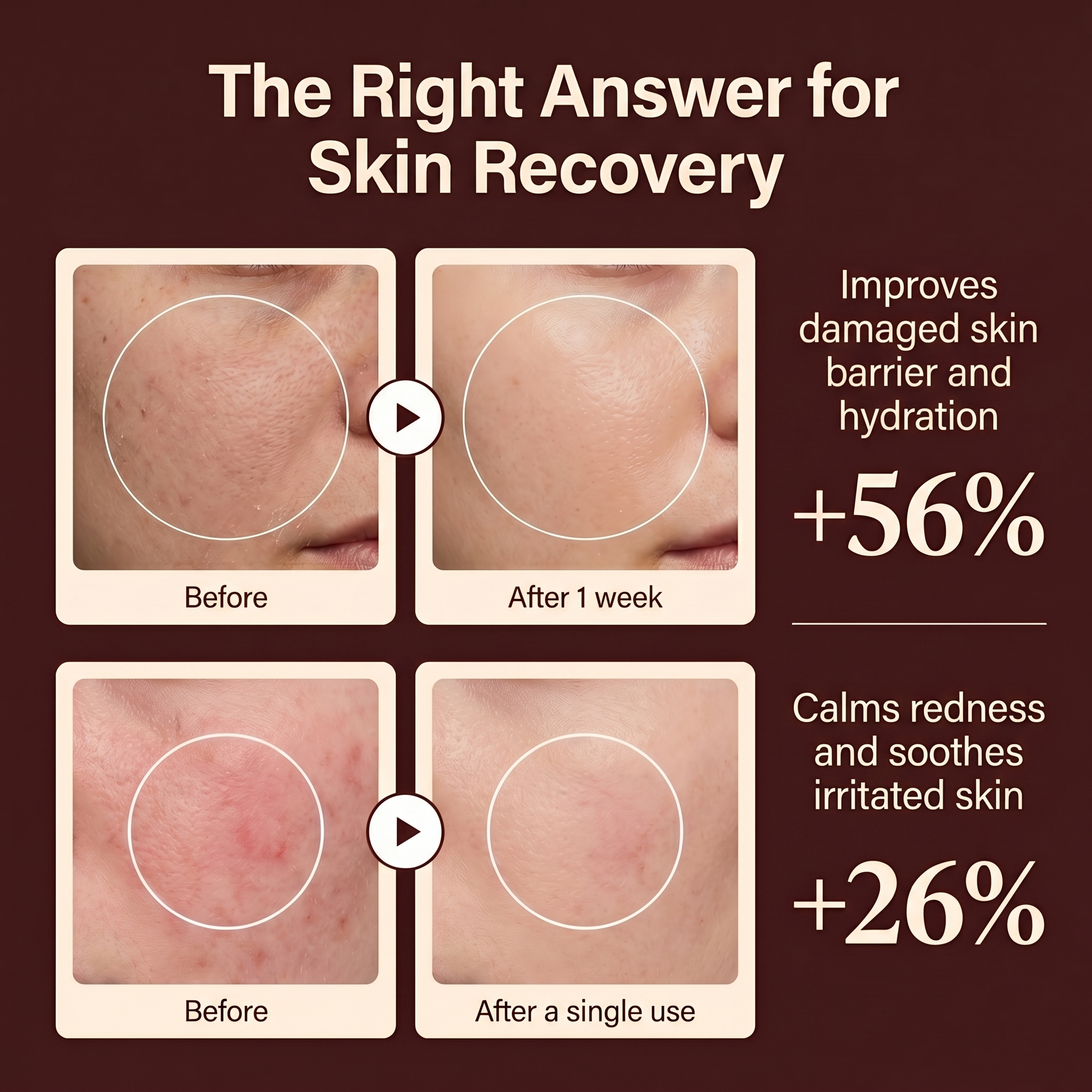PDRN Skin Reset Cream