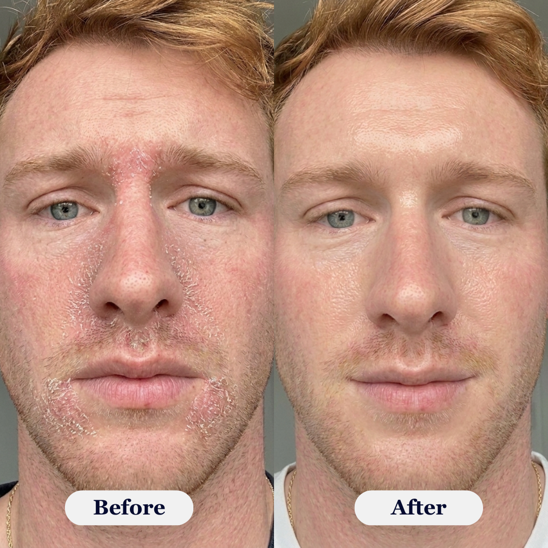 Rova Rejuvenating PDRN Cream