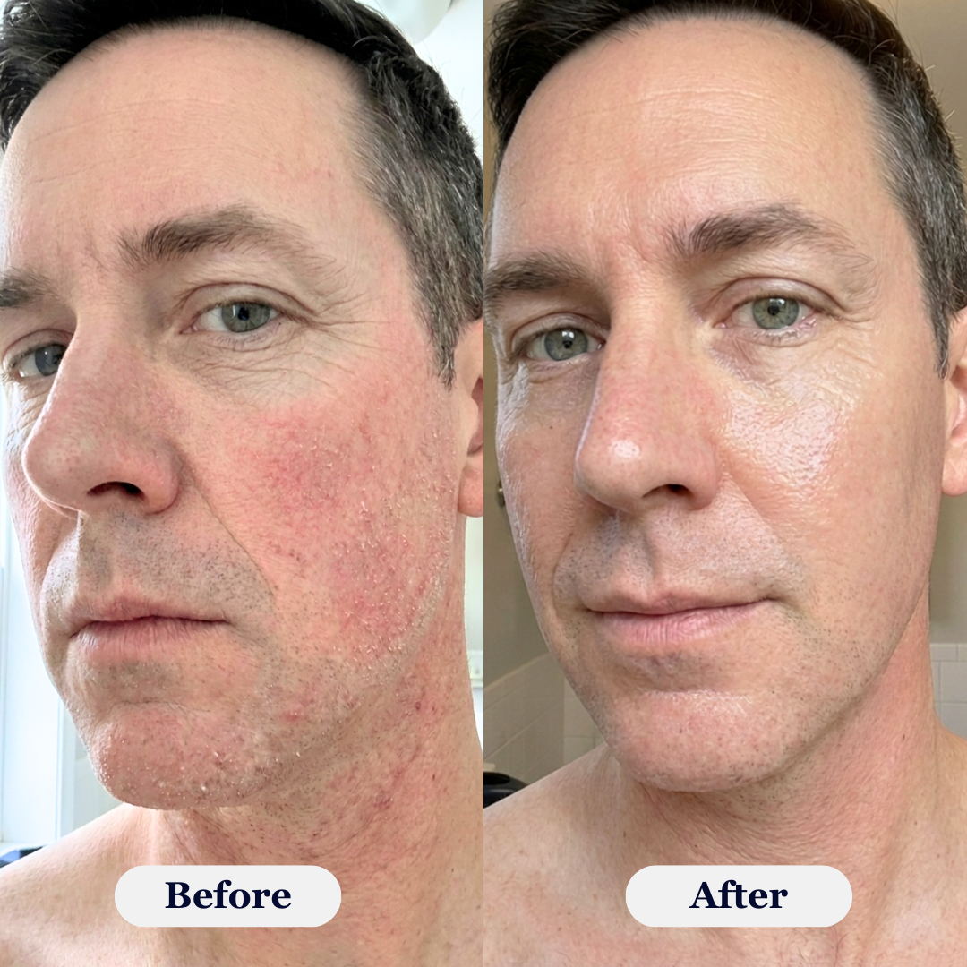 Rova Rejuvenating PDRN Cream