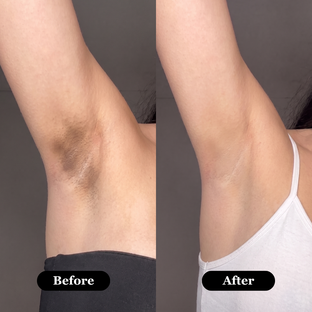 Rova Retinal Skin Booster Serum